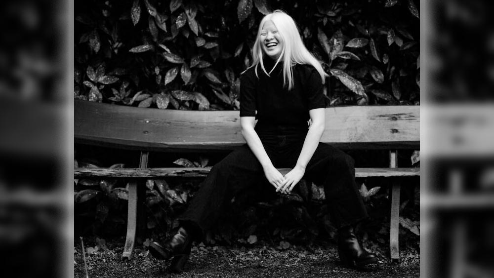 বয়স ১৬। তবে ১১ বছর বয়স থেকেই মডেলিংয়ের দুনিয়ায় রয়েছেন হুয়েই। তিনি মনে করেন, মডেলিংয়ের কাজের মধ্যে দিয়েই লক্ষ লক্ষ অ্যালবিনোকে তিনি অনুপ্রাণিত করতে পারেন। তাঁদের প্রতি বৈষম্যমূলক আচরণের জবাবও দিতে পারেন।