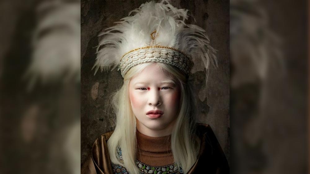 এক সাক্ষাৎকারে হুয়েই বলেছিলেন, ‘‘আমার জন্মের সময়ে চিনে এক সন্তান নীতি চলছিল। এক বার সন্তান হলে আর দ্বিতীয় সন্তানের জন্য সরকারি সুযোগ সুবিধা পাওয়া যেত না। এই পরিস্থিতিতে এই রোগ নিয়ে জন্মেছিলাম আমি। বাবা-মা আমাকে দুর্ভাগ্য ছাড়া আর কি ই বা মনে করতেন?’’