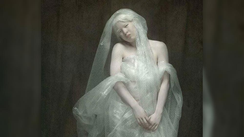 নিজের জন্মদিন জানেন না হুয়েই। এক বছর আগে পর্যন্ত নিজের বয়স সম্পর্কেও কোনও ধারণা ছিল না তাঁর। হাতের এক্সরে করাতে গিয়ে চিকিৎসকরা তাঁর বয়স সম্পর্কে একটি ধারণা পান। গত বছর হুয়েই জানতে পারেন তাঁর বয়স ১৫-র আশেপাশে। 