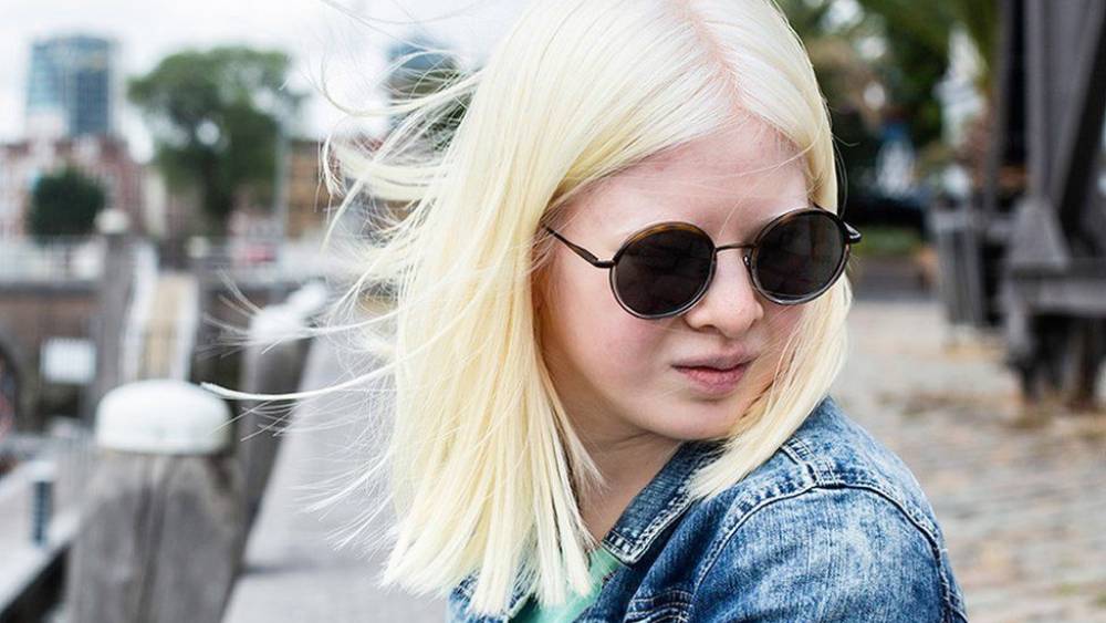 হুয়েই জানিয়েছেন, ওই ডিজাইনারের ছেলের ঠোঁটের সমস্যা ছিল। তিনি এমন পোশাক বানাতে চেয়েছিলেন, যাতে পোশাক ছেড়ে ঠোঁটের দিকে নজর না যায়। হুয়েইকে ওই বিশেষ ফ্যাশন শোয়ে যোগ দিতে বলেন তিনি। হুয়েই জানিয়েছেন, বছর চারেক আগের সেই অভিজ্ঞতার কথা জীবনে ভুলবেন না তিনি। 