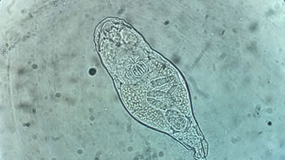 প্রতিকূল পরিবেশে এরা নিজেদের সমস্ত জৈবিক ক্রিয়া স্বেচ্ছায় বন্ধ করে দিতে পারে। এই ভাবে তারা মৃতের মতো থেকে যেতে পারে।