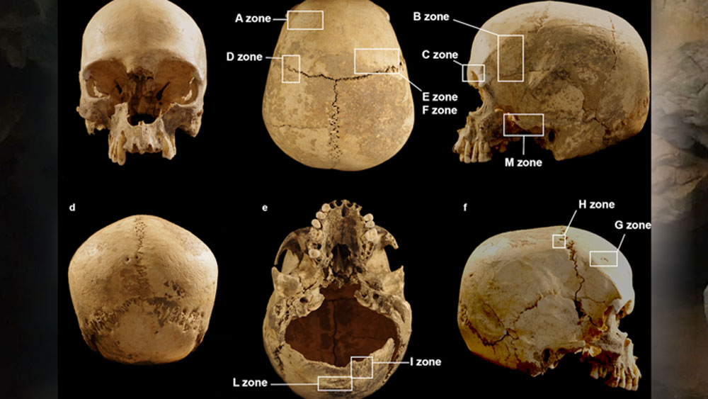 অবশেষে ২০২১ সালে পৌঁছে সেই রহস্যের সমাধান হয়। ২০১৭ সাল থেকে খুলি নিয়ে গবেষণা শুরু করেছিলেন একদল বিজ্ঞানী। তাঁরাই রহস্যের সমাধান করেন।