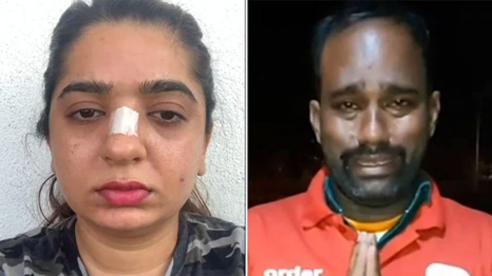 নাক দিয়ে রক্ত ঝরছে, হাসপাতালের বেডে শুয়ে চিকিৎসাধীন অবস্থায় এবং নাকে ব্যান্ডেজ করা অবস্থায় একাধিক ভিডিয়ো সোশ্যাল মিডিয়ায় শেয়ার করেছিলেন চন্দ্রাণী। তিনি অভিযোগ তুলেছিলেন, জোম্যাটোর ডেলিভারি বয় নাকে ঘুঁসি মেরে তাঁকে আহত করেছেন।