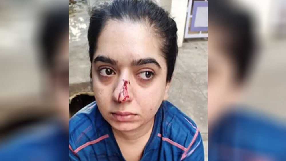 হাসপাতালের বিছানায় শুয়ে চিকিৎসাধীন অবস্থাতেই নাক দিয়ে রক্ত ঝরার একাধিক ভিডিয়ো নেটমাধ্যমে পোস্ট করে রাতারাতি সারা দেশের কাছে পরিচিত মুখ হয়ে উঠেছিলেন তিনি।