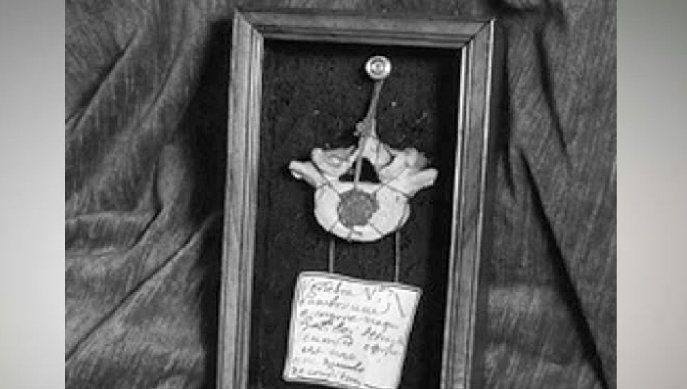 সংরক্ষণ করে রাখা রয়েছে তাঁর কিছু দাঁত এবং মেরুদণ্ডের কশেরুকা। এই সমস্ত শরীরের অংশগুলি আসলে ১৭৩৭ সাল থেকে জাদুঘরে রাখা। ওই সময় একটি স্মৃতিসৌধ থেকে অন্য সৌধে নিয়ে যাওয়া হচ্ছিল তাঁর মৃতদেহ। তখনই এগুলি খুলে পড়ে যায়।