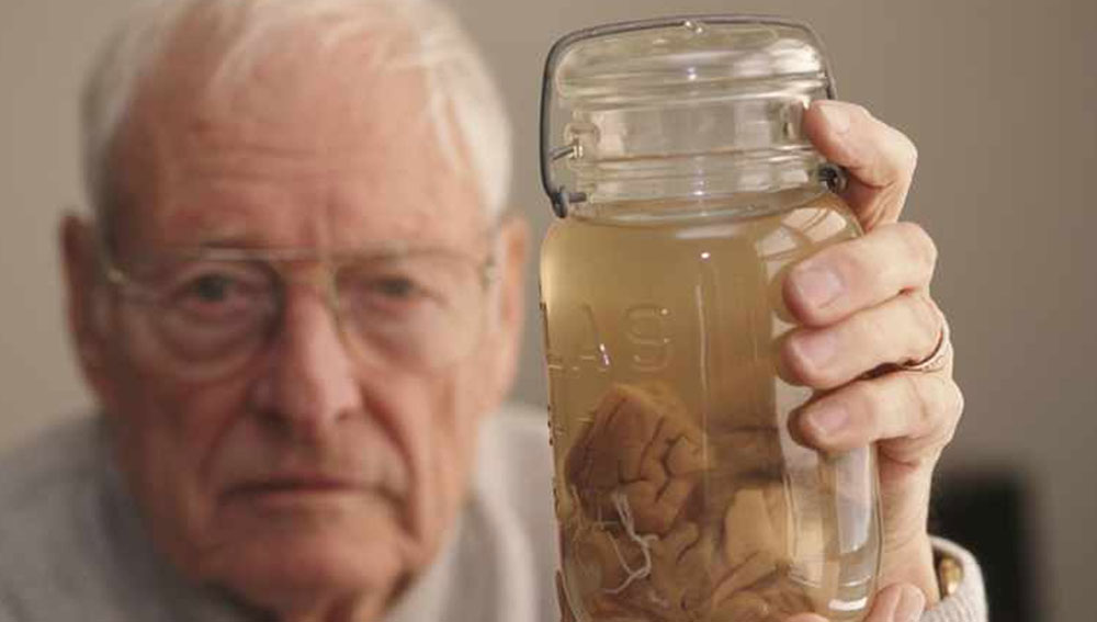 ১৯৫৫ সালে মৃত্যু হয় তাঁর। দেহের ময়নাতদন্ত করেছিলেন থমাস হার্ভে নামে এক চিকিত্সক। গবেষণার জন্য তিনি তাঁর মস্তিষ্কের ২৪০টি টুকরো করেছিলেন। তার কিছু টুকরো সংরক্ষণ করা রয়েছে ওয়াশিংটনের ন্যাশনাল মিউজিয়াম অব হেল্থ অ্যান্ড মেডিসিন-এ। বাকি অর্ধেক রয়েছে ফিলাডেলফিয়ার একটি জাদুঘরে।