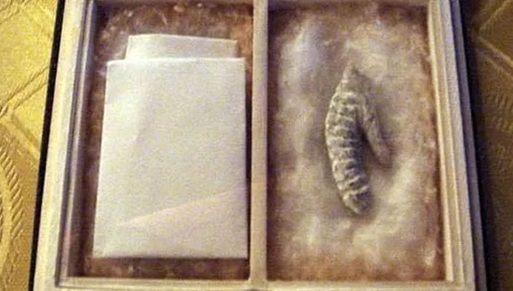 সম্রাটের মৃত্যুর পর এক ব্রিটিশ চিকিৎসক তাঁর মৃতদেহের ময়নাতদন্ত করেছিলেন। তখনই তিনি নেপোলিয়নের লিঙ্গ দেহ থেকে আলাদা করে নিয়েছিলেন। ১৯৬৯ সালে ২৯০০ ডলারে আমেরিকার একজন ইউরোলজিস্ট সেটি কিনেছিলেন।