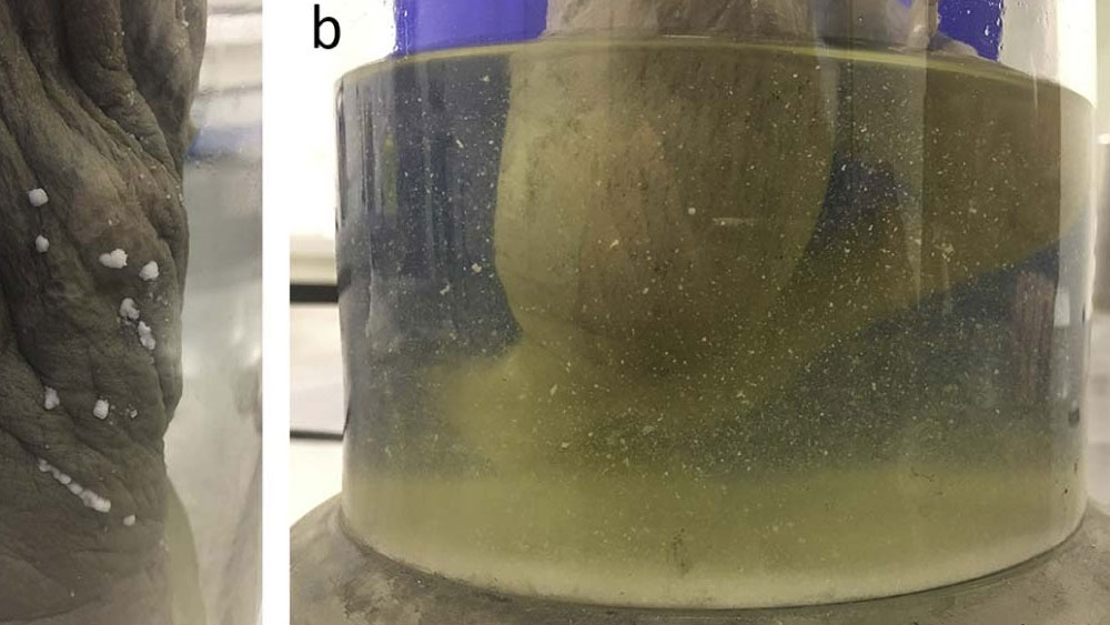 তবে হৃৎপিণ্ডতে কোনও ভাবেই কাটাছেঁড়া করা হয়নি। সংরক্ষিত জারের বাইরে থেকে দেখে এই রিপোর্ট দিয়েছেন তাঁরা। যা ২০১৭ সালে প্রথম প্রকাশিত হয় আমেরিকান জার্নাল অব মেডিসিন-এ।