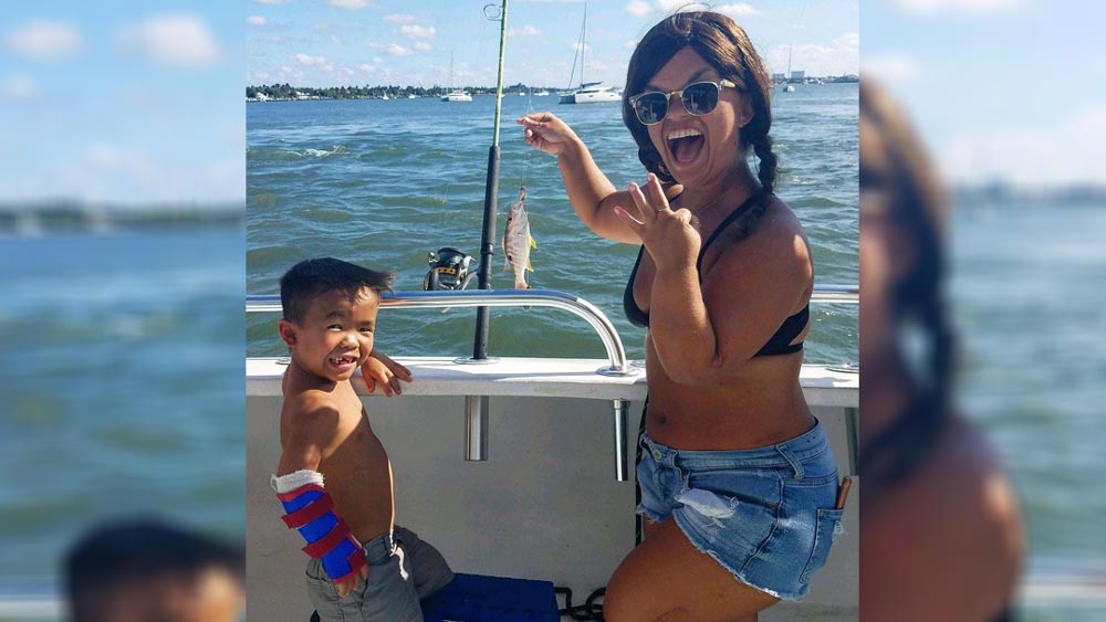 হাত এবং পায়ের হাড়ের নির্দিষ্ট অংশ ভেঙে ফেলা হয়েছে প্রথমে। তার পর দুই টুকরোর মাঝে স্টিলের রড ঢুকিয়ে স্ক্রু দিয়ে সেটিকে লাগিয়ে দেওয়া হয়। পা এবং হাতে দুই অংশেই একই পদ্ধতির প্রয়োগ করা হয়।