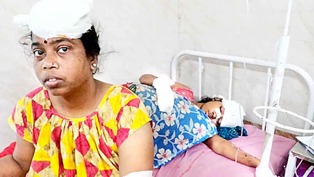  হামলার পরে হাসপাতালে বেহালার বাসিন্দা রেখা হালদার ও তাঁর মেয়ে লতা হালদার । সোমবার।