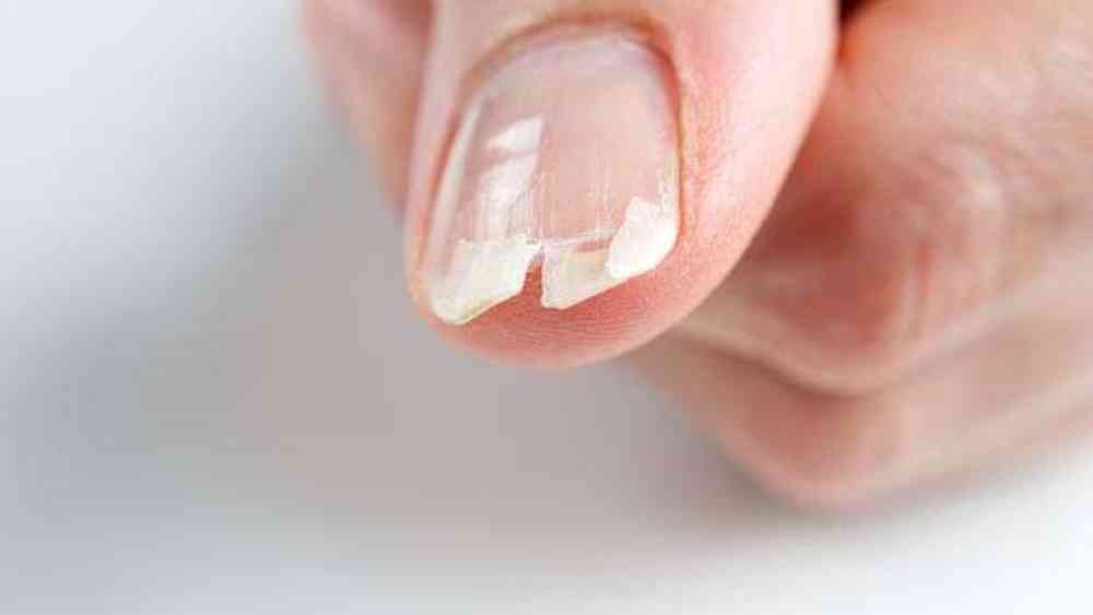 প্রতীকী ছবি।