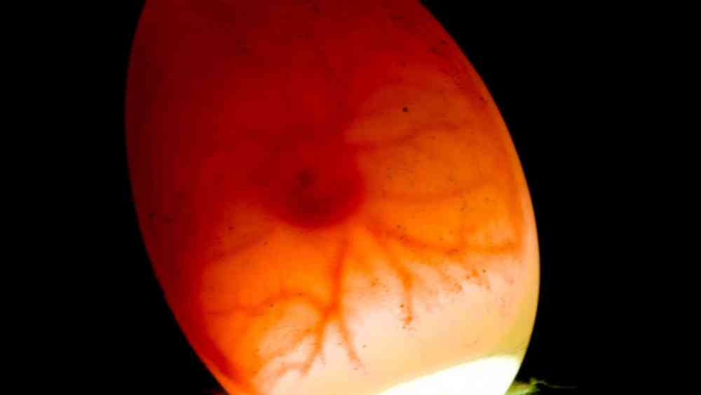 আলোর সামনে খারাপ ডিম ধরলে এমন দাগ দেখা যায়।