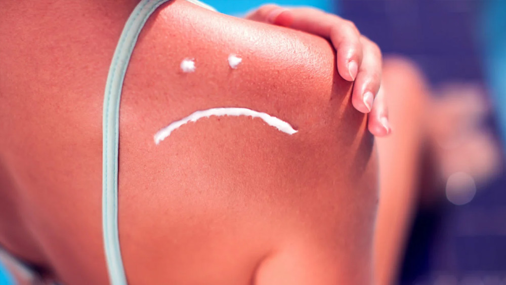 এ ছাড়া আর কী কী সমস্যা হতে পারে? হলে কী করবেন, সেই পরামর্শও দিয়েছেন বিশেষজ্ঞরা। প্রথমেই সানবার্ন বা প্রবল রোদে ত্বক পুড়ে যাওয়ার ব্যাপারে সতর্ক থাকতে বলেছেন চিকিৎসকরা। এ ক্ষেত্রে সাধারণত ত্বক লাল হয়ে যায়। সঙ্গে ত্বকে ফুসকুড়িও দেখা যেতে পার। 