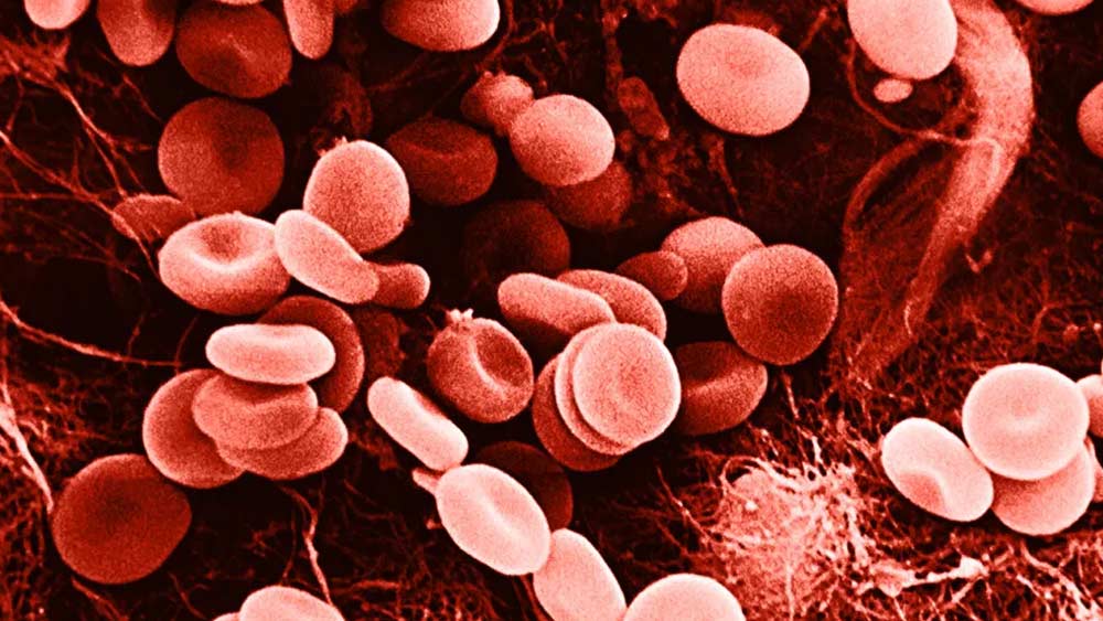 রক্তে লোহিত কণিকা এবং লোহার পরিমাণ বাড়াতেও সাহায্য করে শিলাজিৎ। অন্তত এমনটাই মত বিশেষজ্ঞেদের একাংশের।