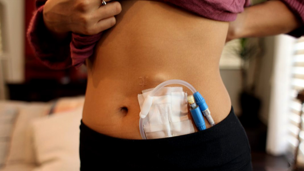 ডাক্তারি পেশায় থাকাকালীন সে জানত, বেআইনি ভাবে কিডনি প্রতিস্থাপন করলে বিপুল পরিমাণ টাকা রোজগার করা যায়। পুলিশের দেওয়া তথ্য অনুযায়ী, ১৯৯৪ থেকে ২০০৪ সাল পর্যন্ত টানা ১০ বছর সে ১২৫টি কিডনি প্রতিস্থাপন করেছিল। একটি কিডনি প্রতিস্থাপন করতেই সে পাঁচ থেকে সাত লক্ষ টাকা পর্যন্ত পেত।