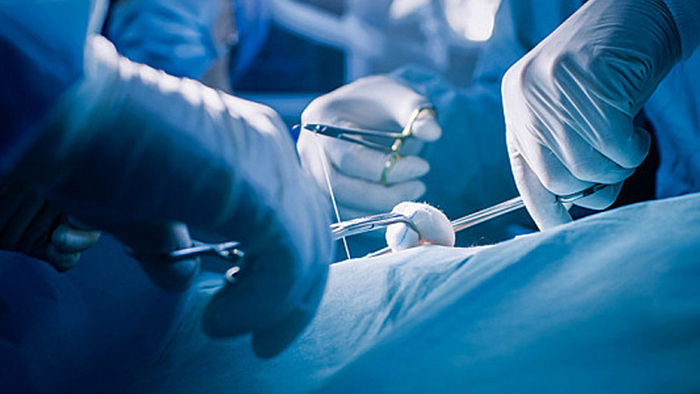 বেআইনি ভাবে টাকা রোজগারের জন্য প্রথমে একটি ভুয়ো গ্যাস এজেন্সিও খুলেছিল দেবেন্দ্র। তবে, ব্যবসায় লোকসান হওয়ায় সে কিডনি প্রতিস্থাপন করবে বলে সিদ্ধান্ত নেয়।