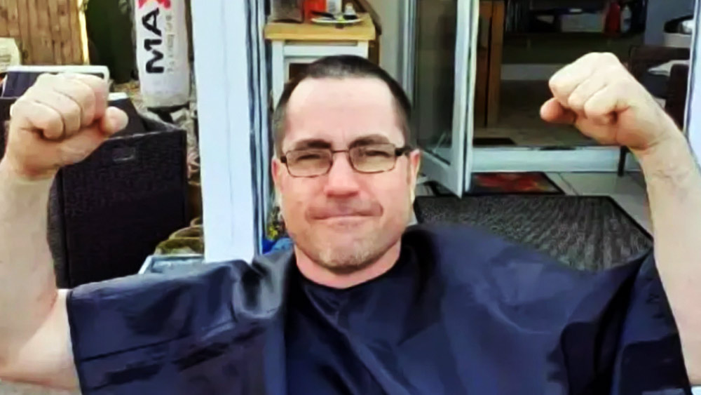 স্টিফ-পার্সন সিন্ড্রোম নামক রোগে আক্রান্ত ইংল্যান্ডের ডমিনিক অ্যালডারসন। 