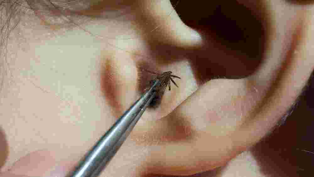 যদি পোকা-মাকড় ঢুকে থাকে তবে তৎক্ষণাৎ চিকিৎসককে দেখানো দরকার।