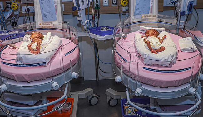 যমজ শিশু