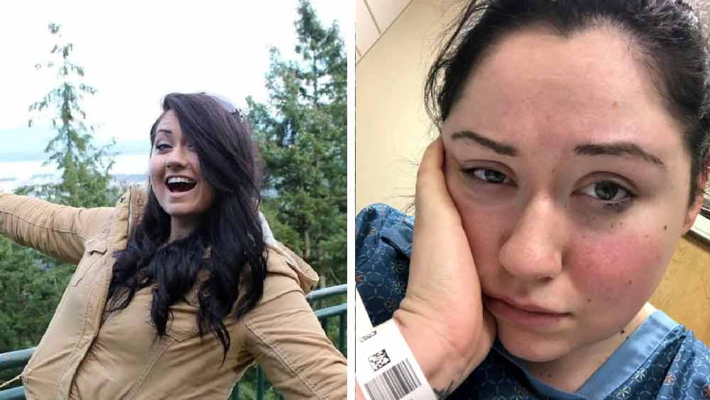 টানা মাত্র তিন মিনিট দাঁড়িয়ে থাকতে পারেন। এর থেকে বেশি দাঁড়িয়ে থাকলেই তাঁর বিপদ। সারা দিনে অজ্ঞান হয়ে যান বার দশেক। কারণ আমেরিকার মেইনের ব্যাঙ্গোরের বাসিন্দা লিন্ডসে জনসন বিরল রোগের শিকার। পৃথিবীর মাধ্যাকর্ষণ শক্তির কারণেই এই বিরল রোগের শিকার লিন্ডসে। আজগুবি মনে হলেও এই ঘটনা সত্যি।