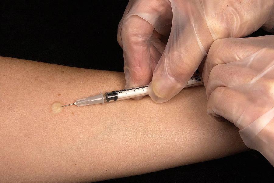 কারা কর্তৃপক্ষ সিদ্ধান্ত নিয়েছিলেন, অ্যালানকে বিষাক্ত ইঞ্জেকশন দিয়ে মৃত্যুদণ্ড দেওয়া হবে। কিন্তু সেই বিষ অ্যালানের শরীরে প্রবেশ করিয়েও তাঁর মৃত্যু হয় নি।