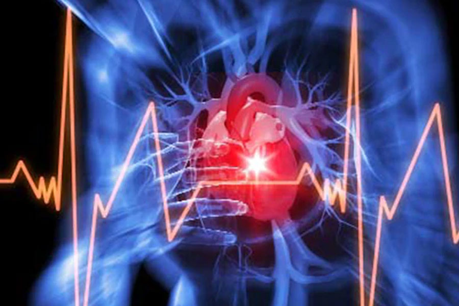 এই প্রকার হার্ট অ্যাটাক হলে রোগীর বুকে তীব্র যন্ত্রণা হয় না, বড়জোর এমনটা হলে রোগী অচৈতন্য হয়ে পড়েন। হার্ট অ্যাটাকের মূল উপসর্গ ব্যথা, আর এ ক্ষেত্রে কোনও রকম ব্যথা হয় না, তাই একে ‘সাইলেন্ট হার্ট অ্যাটাক’ বলা হয়।