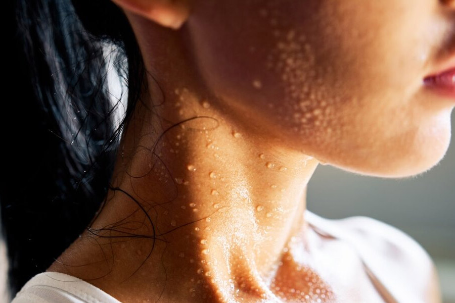 শীতকালেও অস্বাভাবিক ভাবে ঘেমে যাচ্ছেন? কিংবা মাঝেমাঝেই ঠান্ডায় কাঁপুনি দিচ্ছে? এই লক্ষণগুলি দেখা দিলেও সাবধান হতে হবে।