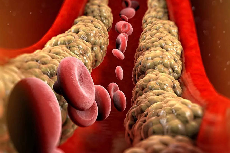 ধরুন আপনার কোনও রোগ নেই, তবুও ৬ মাস অন্তর অন্তর শারীরিক পরীক্ষা করাতেই হবে। ডায়াবিটিস, কোলেস্টেরল, রক্তচাপ বেড়েছে কি না তা পরীক্ষা করিয়ে নিলেই ভাল। এই সব রোগ শরীরে বাসা বাঁধলেই কিন্তু বাড়ে হৃদ্‌রোগের ঝুঁকি!