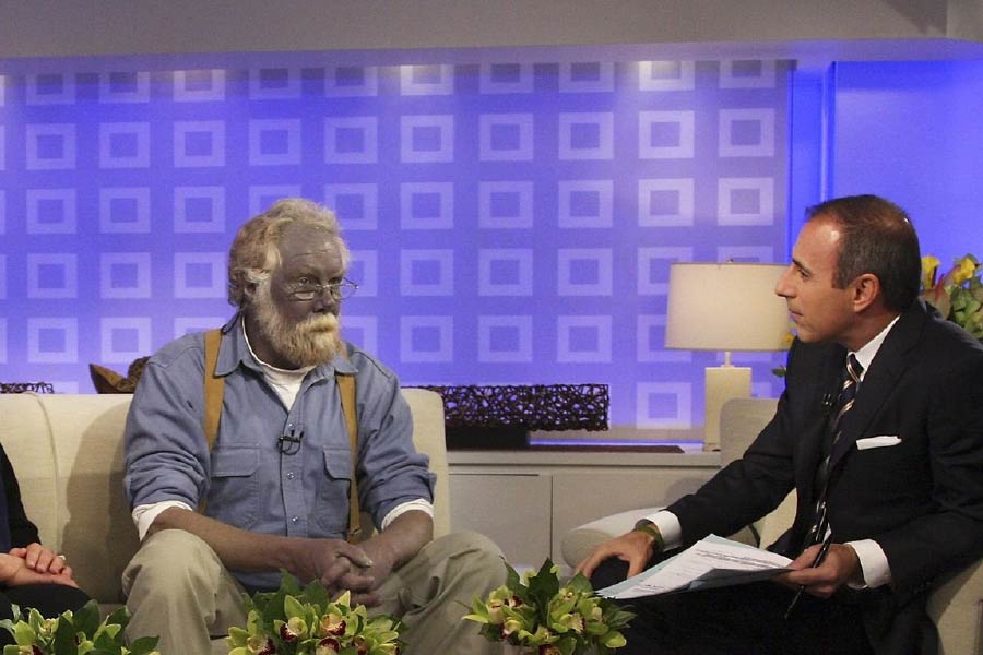 কী করবেন না করবেন ভেবে চিন্তায় পড়েছিলেন পল। ওই সময় সংবাদপত্রে একটি বিজ্ঞাপন চোখে পড়ে তাঁর। সেই বিজ্ঞাপনী প্রচারে ভুলে বাড়ির কাছের দোকানে যান কারাসন। কিনে ফেলেন একটি ‘সাপ্লিমেন্ট’।