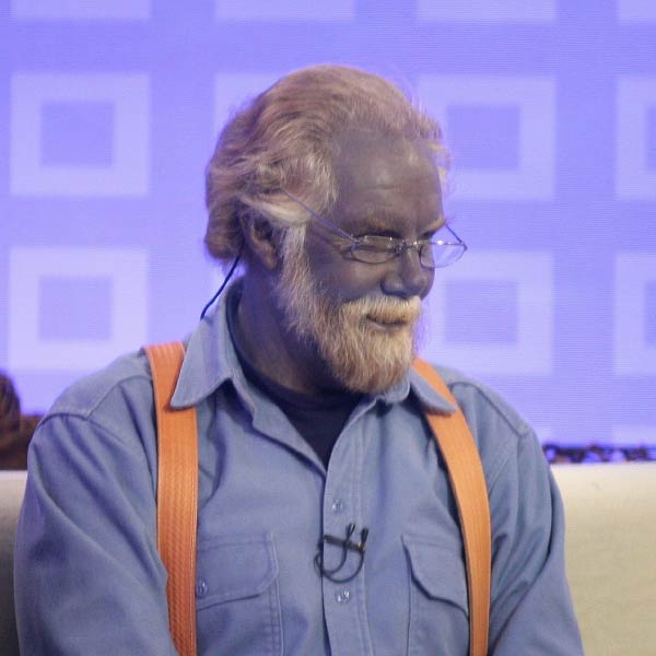 ওই বিজ্ঞাপনের বর্ণনা মেনে রোজকার খাবারের তালিকায় সাপ্লিমেন্টটিকে যোগ করেন পল। প্রথমে অবশ্য কোনও পার্শ্বপ্রতিক্রিয়া হয়নি। বরং সাপ্লিমেন্ট খেতে খেতে পলের মনে হয়েছিল, তাঁর ত্বকের সমস্যার সমাধান হচ্ছে।