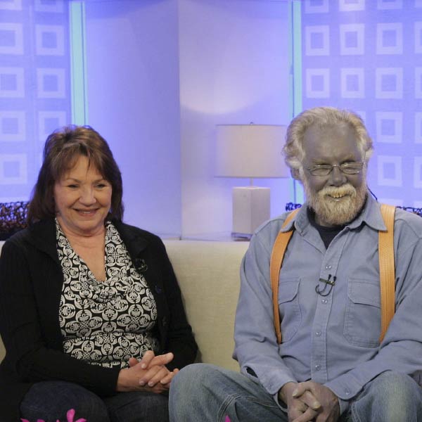 বছরের পর বছর ওই সাপ্লিমেন্ট খেতে থাকেন পল। এর মধ্যে হঠাৎ এক দিন আয়নায় নিজেকে ভাল করে দেখে চমকে উঠলেন তিনি। এ কী!