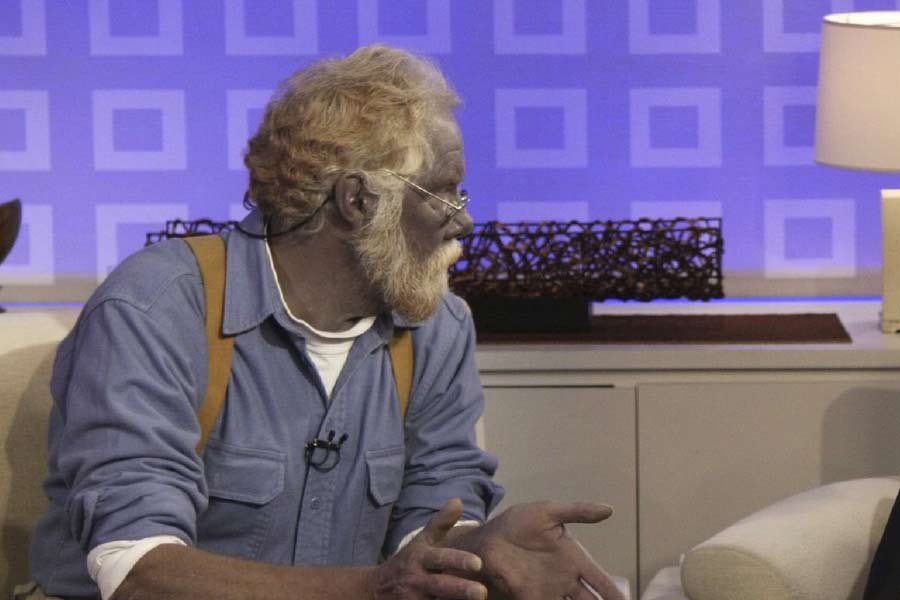 ২০০৮ সালে পল একটি টিভি চ্যানেলে সাক্ষাৎকার দেন। ত্বকের সমস্যার জন্য কেউ যাতে বিজ্ঞাপনী প্রচারে ভুলে তাঁর মতো কাজ না করেন, এই বার্তা দেন পল। জানান, রুপো শরীরে যাওয়ার পর কী মারাত্মক ক্ষতি হয়েছে তাঁর।