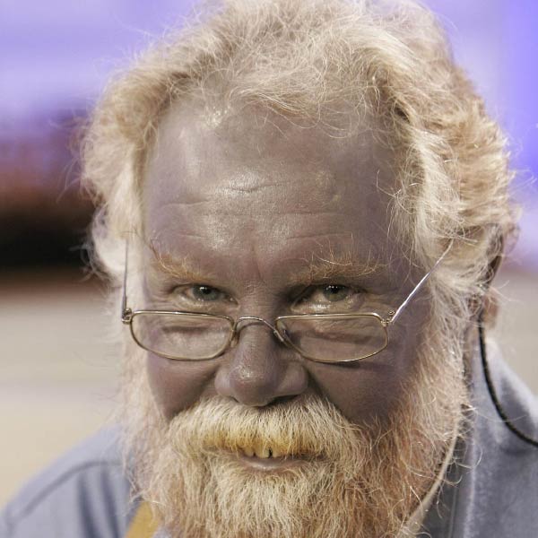 পলের গায়ের রং বদলে যাওয়ায় তিনি খবরের শিরোনামে চলে আসেন। কচিকাঁচারা তাঁকে ‘পাপা স্মার্ফ’ বলে ডাকতে শুরু করে। তাতে অবশ্য খুশিই হতেন পল কারাসন। হাসি ফুটে উঠত ‘নীল মানুষ’টির মুখে। সেই হাসির ভিতরে কি দুঃখ ছিল? জানা যায়নি। তবে বড়রা যখন ওই নামে ডাকতেন প্রচণ্ড রেগে যেতেন তিনি।