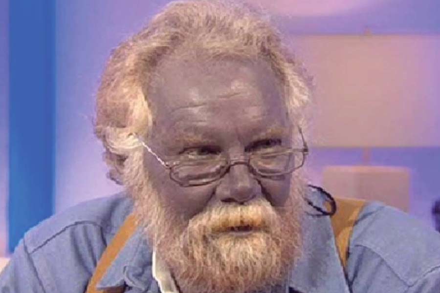 অনেকের আবার দাবি, পলের কেনা সাপ্লিমেন্টে এমন সব মিশ্রণ মেশানো হয়েছে যা আমেরিকায় নিষিদ্ধ। ওই সবের বিষক্রিয়ায় ভুগতে হয়েছে কারাসনকে।