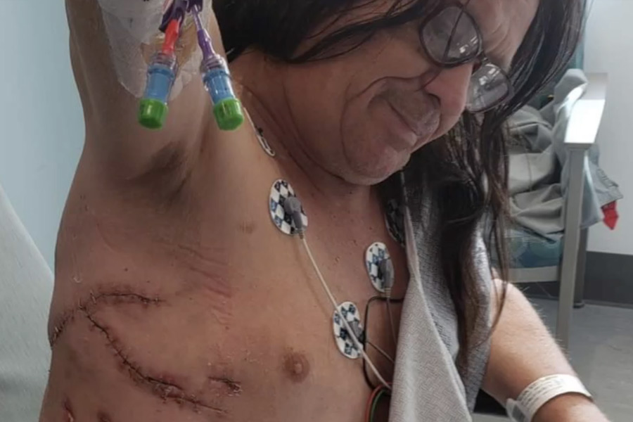 বর্তমানে অনেকটাই সুস্থ হয়েছেন তিনি। চিকিৎসাধীন অবস্থায় তাঁর কিছু ছবি প্রকাশ্যে এসেছে। দেখা গিয়েছে, শরীরের নানা অং‌শে কাটাছেঁড়া। 