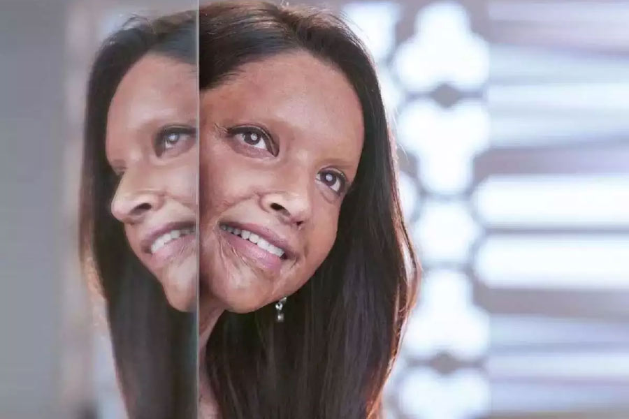 দীপিকা ছবিতে মেকআপ করে অ্যাসিড আক্রান্তের যে ‘লুক’ তৈরি করেছিলেন, তাঁর অনুরাগীদের কাছে অনুরোধ করেছিলেন, তাঁরাও যেন মেকআপ করে ওই ধরনের ‘লুক’ তৈরি করেন। 