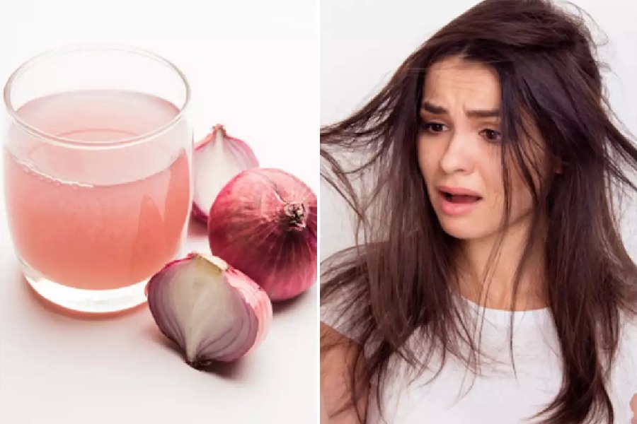 পেঁয়াজের রস সরাসরি লাগাতে পারেন মাথায়। 