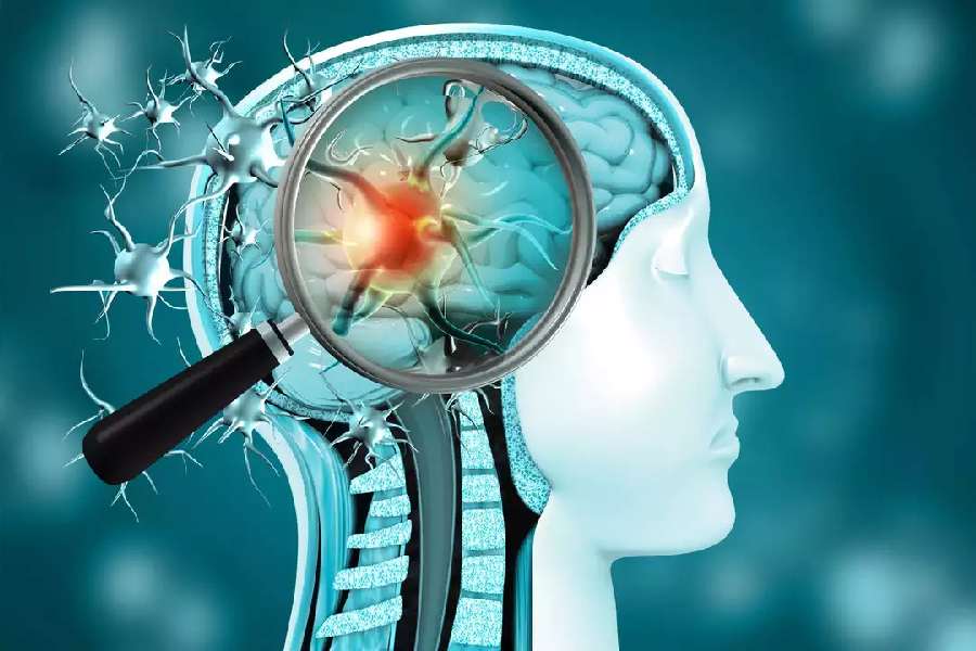 জলবাহিত অ্যামিবা তখন নাক দিয়ে মস্তিষ্কে প্রবেশ করে। মস্তিষ্কের ধমনীগুলিকে খেয়ে নষ্ট করে ফেলে ঘিলুখেকো অ্যামিবা। শুরু হয় মস্তিষ্কে মারাত্মক সংক্রমণ। যার নাম প্রাইমারি অ্যামেবিক মেনিঙ্গোএনসেফেলাইটিস (প্যাম)। মস্তিষ্কে এই সংক্রমণ হলে তা থেকে মৃত্যু এক রকম অবশ্যম্ভাবী। 