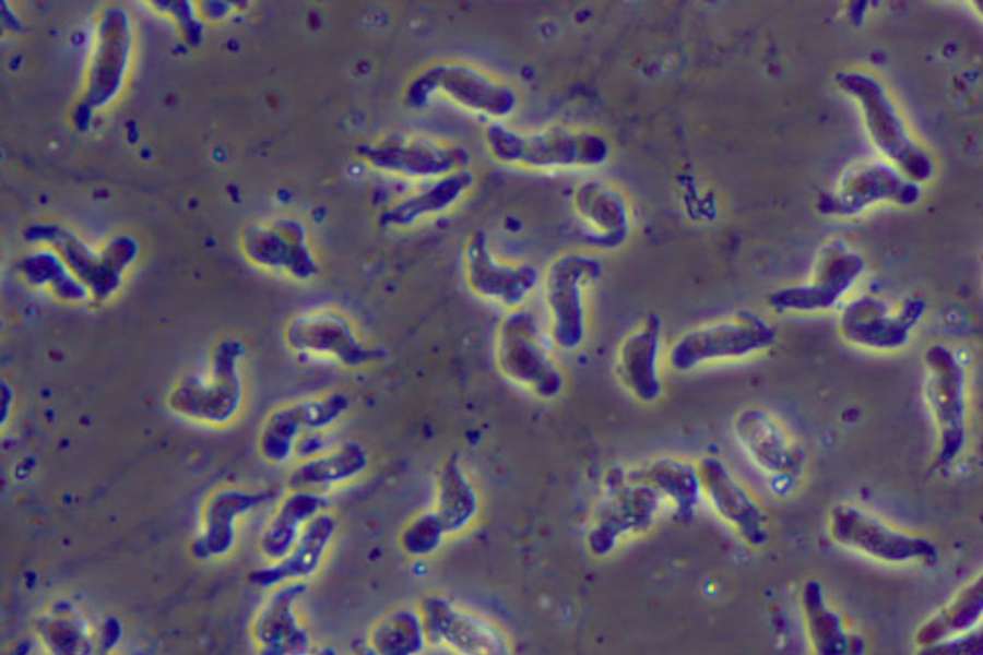 তবে চিকিৎসকেরা জানাচ্ছেন, এখনও পর্যন্ত মানবদেহ থেকে মানবদেহে এই সংক্রমণ ছড়ানোর কোনও প্রমাণ পাননি তাঁরা। 