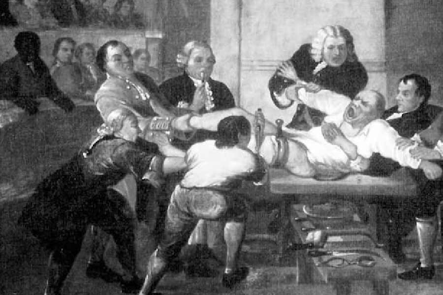 কত ক্ষণ সময়ে কত জটিল অস্ত্রোপচার করতে পারেন তা নিজে থেকে পরখ করে দেখতেন রবার্ট। কিন্তু সময়ের সঙ্গে খেলা করতে গিয়েই ঘটল বিপদ। অস্ত্রোপচার করতে গিয়ে এক সহযোগীর হাতের আঙুলই কেটে ফেললেন তিনি।