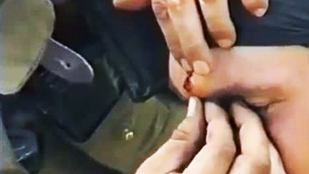 বুলেটবিদ্ধ হওয়ায় কোথায় যন্ত্রণায় কাতরাবেন, তা নয়। ওই ভিডিয়োতে দেখা গিয়েছে, বেশ নির্বিকার ভঙ্গিতেই রয়েছেন তিনি। কালো কাপড়বাঁধা কপাল থেকে বুলেট টেনে খুলে বার করছেন অন্যান্য সেনা। যুদ্ধের ময়দানে এই ‘অস্ত্রোপচারে’ খানিকটা ‘ধর তক্তা, মার পেরেক নীতি’-ই নিয়েছেন রাশিয়ান সেনারা।