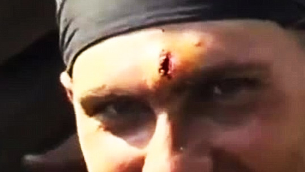 বুলেটবিদ্ধ হলেও রাশিয়ান ওই সেনার নির্বিকার মুখ দেখে ‘টার্মিনেটর’ ছাড়া আর কার কথাই বা মনে পড়বে! 