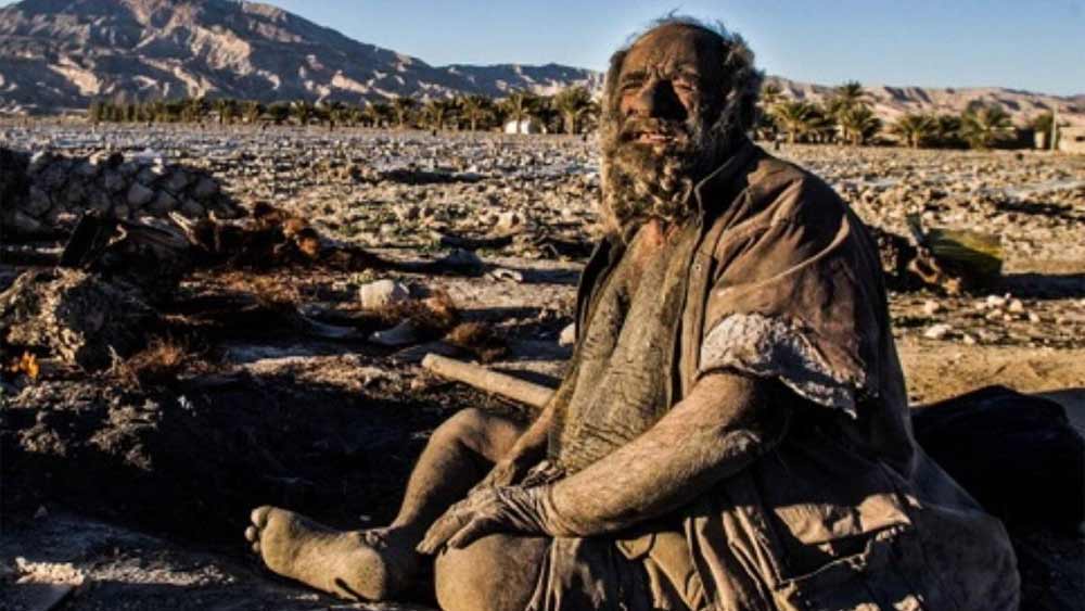 মৃত্যুর আগে ইরানের ওই বৃদ্ধ নাকি টানা ৫০ বছর ধরে স্নানের জল গায়ে ঢালেননি। সে দেশের সংবাদমাধ্যমে তাঁর এ হেন ‘কীর্তি’ জেনে অনেকেরই চোখ কপালে। তাঁদের প্রশ্ন, তবে কি এই বৃদ্ধই দুনিয়ার সবচেয়ে ‘নোংরা, অপরিষ্কার’ ব্যক্তি?