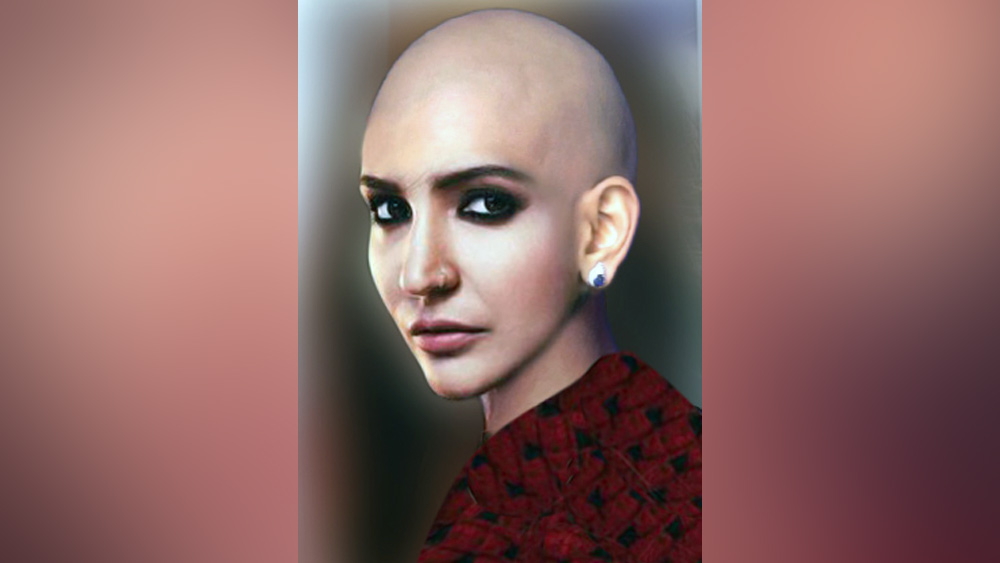 ‘অ্যায় দিল হ্যায় মুশকিল’ ছবির অন্তিম পর্বে অনুষ্কা শর্মাকে ক্যানসারে আক্রান্ত রোগী হিসাবে দেখানো হয়। কেমোথেরাপি চলার ফলে মাথার সমস্ত চুল উঠে গিয়েছে তা দেখানো হয়েছিল। তবে, এ ক্ষেত্রে, অনুষ্কা প্রস্থেটিক্সের সাহায্য নেন।