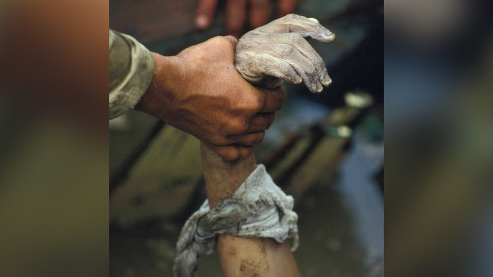 ডুবুরিরাও জলের তলায় গিয়ে ওমায়রার শরীর ধ্বংসস্তূপ থেকে ছাড়ানোর চেষ্টা করেন। তাঁরা দেখেন, ওমায়রার পা বেঁকে গিয়েছে এবং তার পা দু’টি  ইটের দেয়ালের নীচে আটকা পড়েছে। তার পা না কেটে তাকে সম্পূর্ণ ভাবে মুক্ত করা সম্ভব নয় বলেও বুঝতে পারেন উদ্ধারকারীরা।