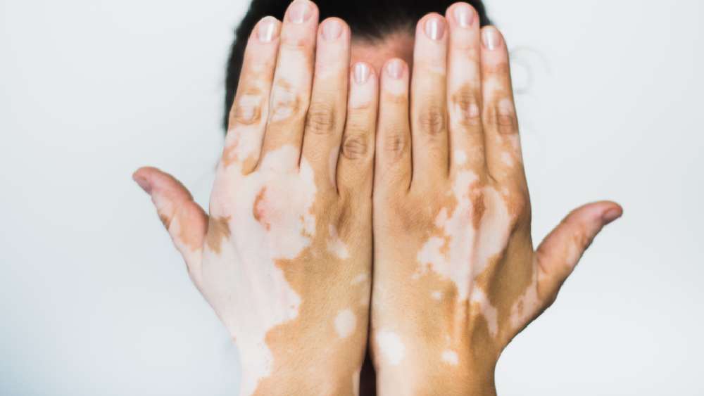 প্রতীকী ছবি