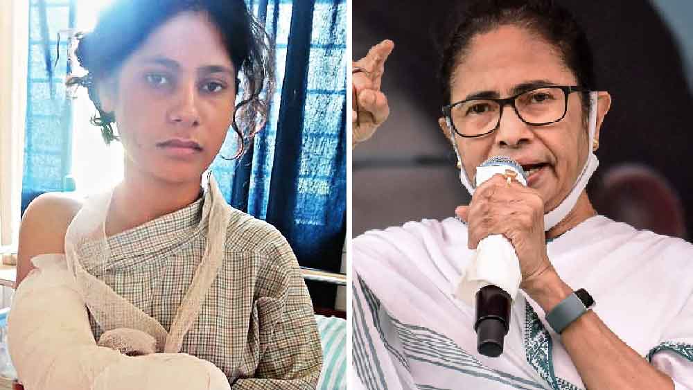 রেণুকে উপযুক্ত কাজ দেবে সরকার, দেবে চিকিৎসার খরচ ও কৃত্রিম হাত: মুখ্যমন্ত্রী