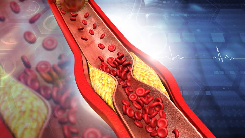 প্রতীকী ছবি