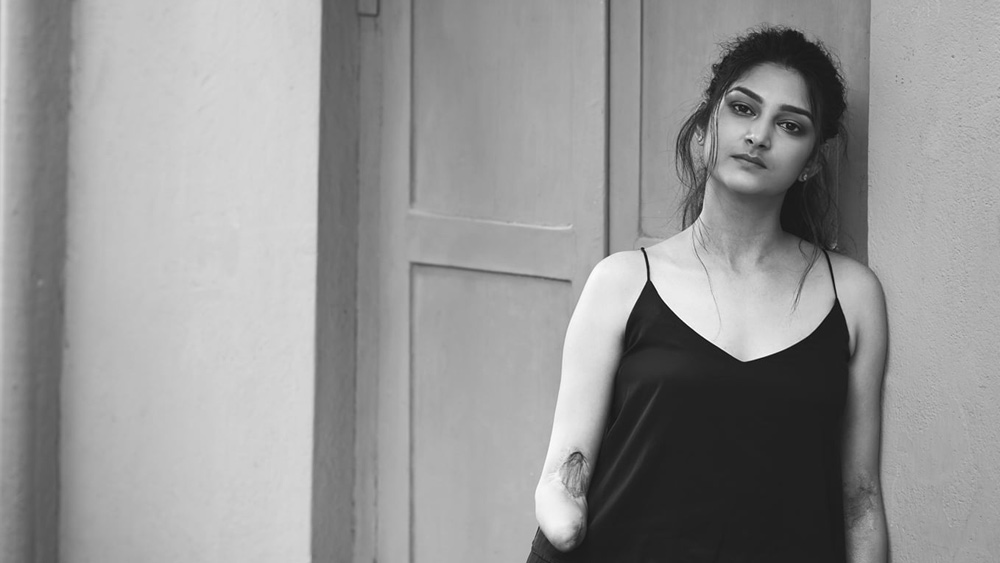 ১১ হাজার ভোল্টের শক খেয়ে মূর্ছা যাওয়া মেয়েটিকে তুলে নিয়ে যাওয়ার সময় কেউ ভাবতে পারেননি যে তাকে বাঁচানো যাবে। শরীরের একাধিক জায়গায় চোট। দগদগে পোড়া প্রায় সারা শরীর। ওই অবস্থায় কাছের একটি বেসরকারি হাসপাতালে ভর্তি করা হয় পৌলোমীকে।