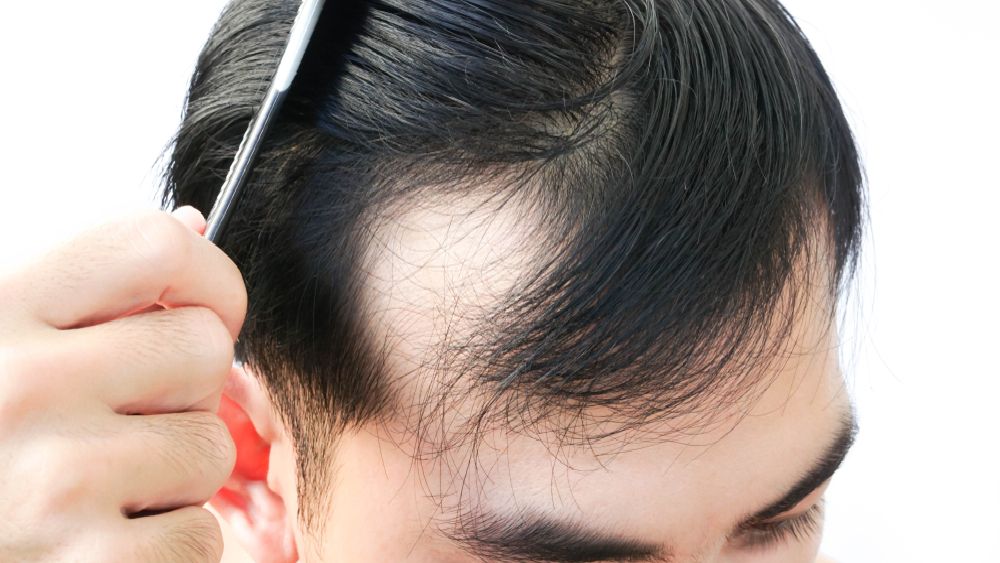 প্রতীকী ছবি।